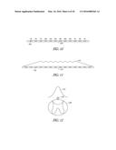 SYSTEMS AND METHODS FOR RECEIVING USER-PROVIDED SELECTION OF ELECTRODE     LISTS diagram and image