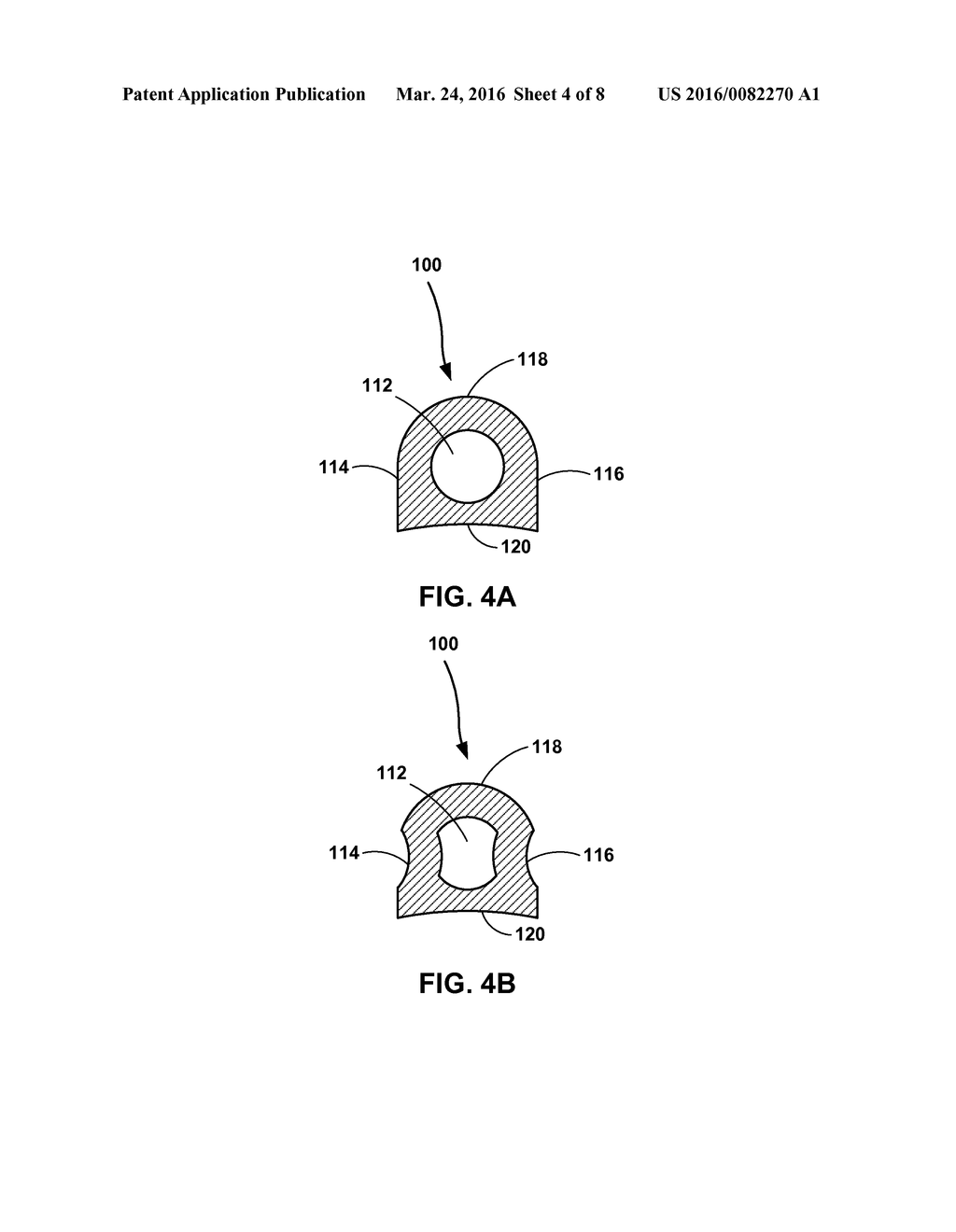 MEDICAL DEVICE FIXATION ATTACHMENT MECHANISM - diagram, schematic, and image 05