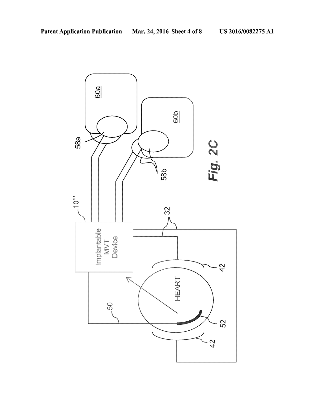 ADAPTIVE MEDIUM VOLTAGE THERAPY FOR CARDIAC ARRHYTHMIAS - diagram, schematic, and image 05