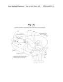 ADAPTIVE MEDIUM VOLTAGE THERAPY FOR CARDIAC ARRHYTHMIAS diagram and image