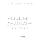 Rescuer Protection from Electrical Shock During Defibrillation diagram and image