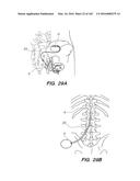 SYSTEM AND METHOD FOR OPTOGENETIC THERAPY diagram and image