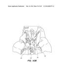 SYSTEM AND METHOD FOR OPTOGENETIC THERAPY diagram and image