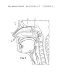 PULSATING ELECTROMAGNETIC AND ULTRASOUND THERAPY FOR STIMULATING TARGETED     HEAT SHOCK PROTEINS AND FACILITATING PROTEIN REPAIR diagram and image