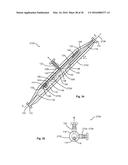 DESANDING APPARATUS AND A METHOD OF USING SAME diagram and image