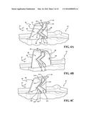 VEHICLE COMPONENT ATTACHMENT STRUCTURE FOR ENERGY ABSORPTION diagram and image