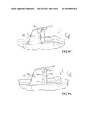 VEHICLE COMPONENT ATTACHMENT STRUCTURE FOR ENERGY ABSORPTION diagram and image