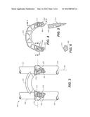 LOWER FORK ALIGNMENT SYSTEM diagram and image