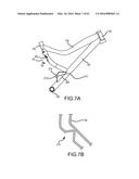 LINK SUSPENSION SYSTEM diagram and image