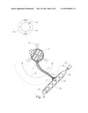 Arc Loading System diagram and image