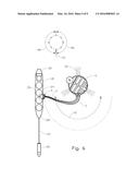 Arc Loading System diagram and image