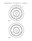 Non-Metal and Hybrid Bottle Crowns With Opener Assembly diagram and image