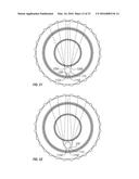 Non-Metal and Hybrid Bottle Crowns With Opener Assembly diagram and image