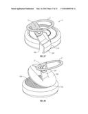 Non-Metal and Hybrid Bottle Crowns With Opener Assembly diagram and image