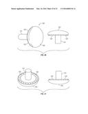 Non-Metal and Hybrid Bottle Crowns With Opener Assembly diagram and image