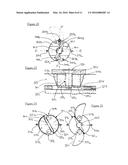 EXTENSIBLE FIXING DEVICE diagram and image