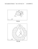 METHOD FOR LOCATING A TARGET AND MULTISTATIC RADAR SYSTEM FOR IMPLEMENTING     SUCH A METHOD diagram and image