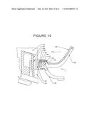 Adjustable Grip Hand Rest diagram and image