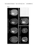 PROCESSING IMAGING DATA TO OBTAIN TISSUE TYPE INFORMATION diagram and image