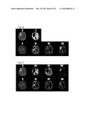 PROCESSING IMAGING DATA TO OBTAIN TISSUE TYPE INFORMATION diagram and image