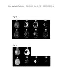 PROCESSING IMAGING DATA TO OBTAIN TISSUE TYPE INFORMATION diagram and image