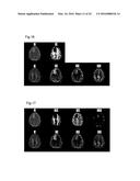 PROCESSING IMAGING DATA TO OBTAIN TISSUE TYPE INFORMATION diagram and image