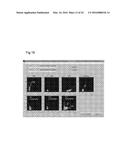 PROCESSING IMAGING DATA TO OBTAIN TISSUE TYPE INFORMATION diagram and image