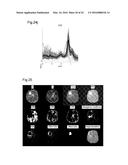 PROCESSING IMAGING DATA TO OBTAIN TISSUE TYPE INFORMATION diagram and image