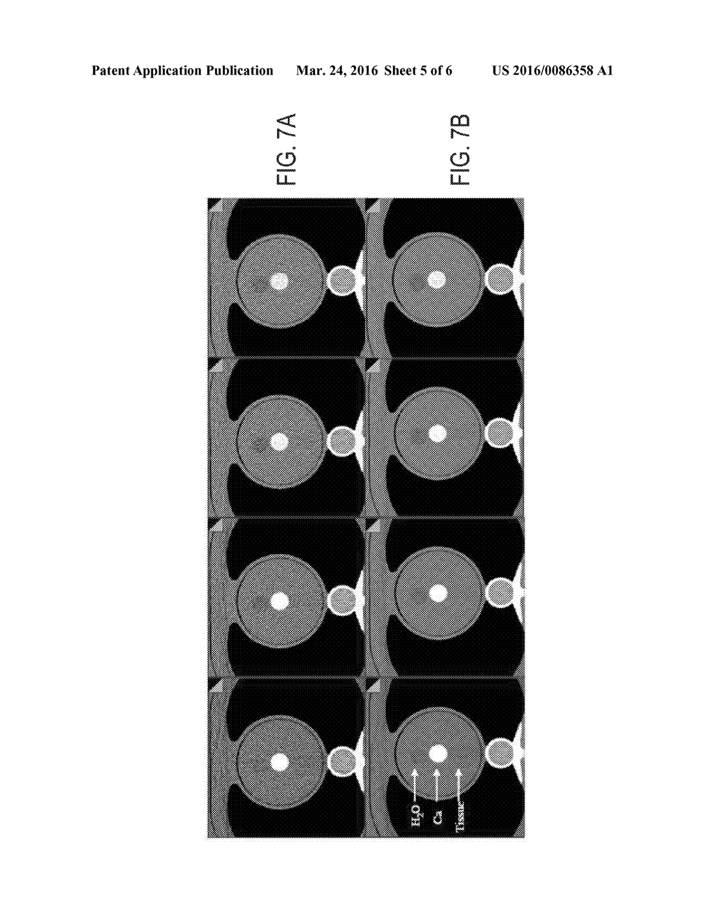 System and Method For Improved Energy Series Of Images Using Multi-Energy     CT - diagram, schematic, and image 06