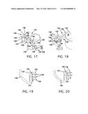 FREE FLOATING INTEGRATED LUG BRIDGE diagram and image