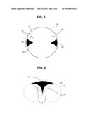 RADOME FOR AN ANTENNA WITH A CONCAVE-REFLECTOR diagram and image