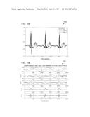 SIGNAL SEGMENTATION AND ANALYSIS diagram and image