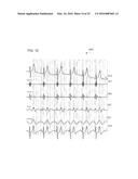 SIGNAL SEGMENTATION AND ANALYSIS diagram and image