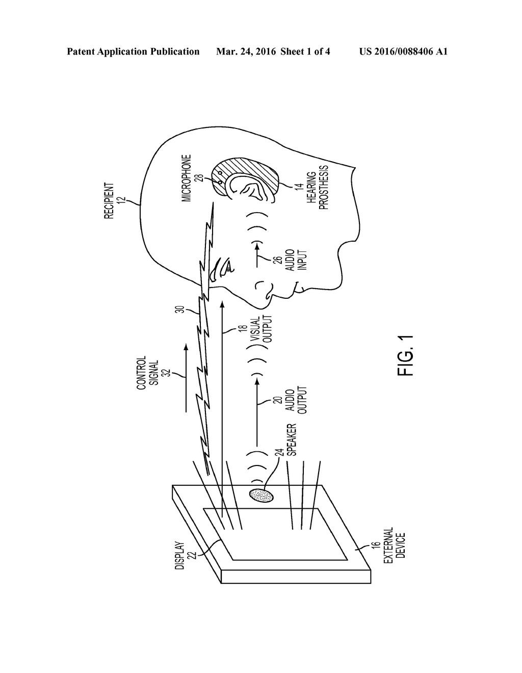 Configuration of Hearing Prosthesis Sound Processor Based on Visual     Interaction with External Device - diagram, schematic, and image 02