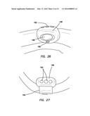 Portable lounge diagram and image