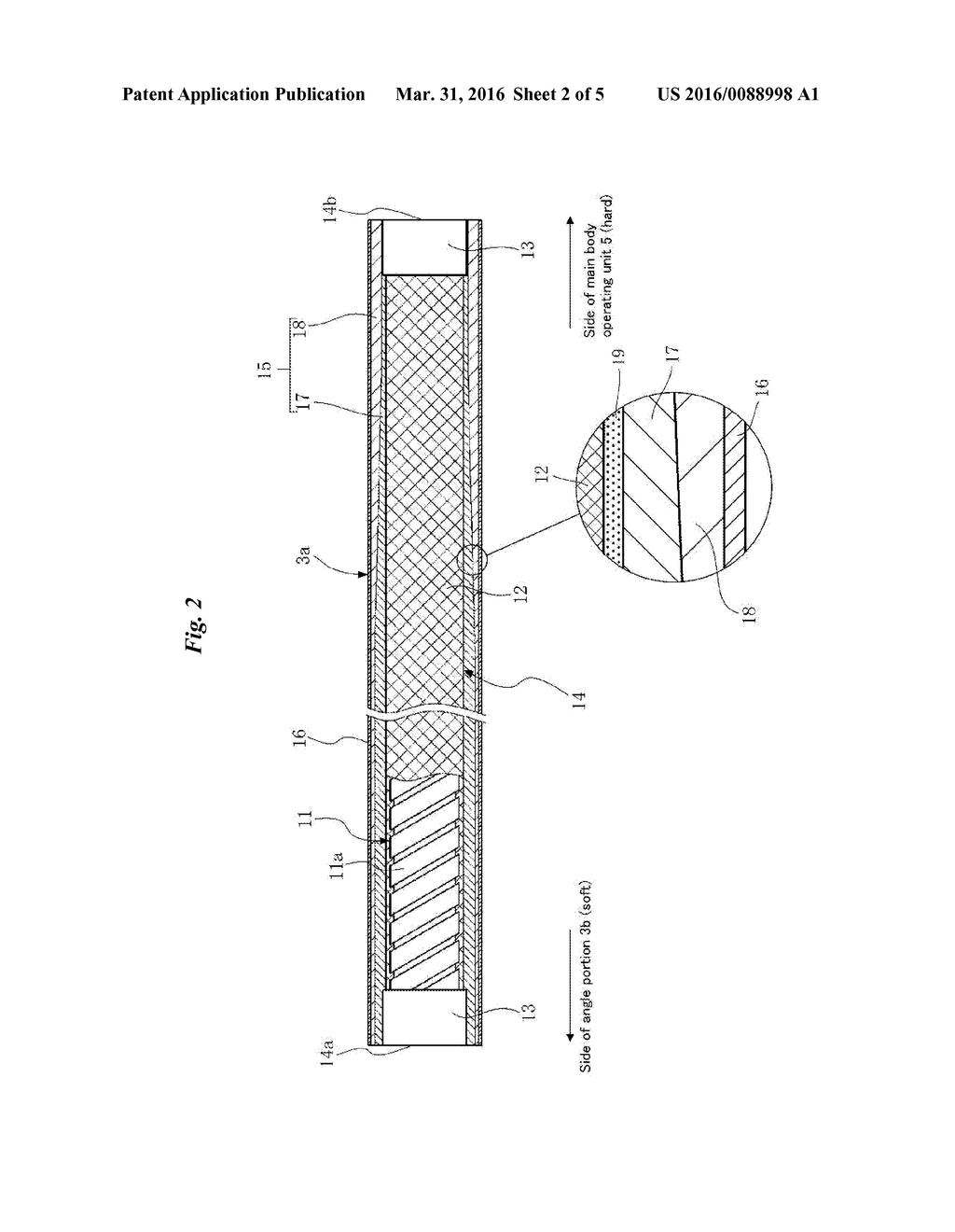 FLEXIBLE TUBE FOR AN ENDOSCOPE, ADHESIVE FOR AN ENDOSCOPE, ENDOSCOPE-TYPE     MEDICAL DEVICE, AS WELL AS METHOD OF PRODUCING A FLEXIBLE TUBE FOR AN     ENDOSCOPE AND METHOD OF PRODUCING AN ENDOSCOPE-TYPE MEDICAL DEVICE - diagram, schematic, and image 03