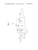 ENDOSCOPE diagram and image