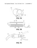 MEDICAL SYSTEMS COMPRISING OPTICAL DEVICES diagram and image