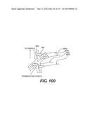 MEDICAL SYSTEMS COMPRISING OPTICAL DEVICES diagram and image