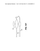 MEDICAL SYSTEMS COMPRISING OPTICAL DEVICES diagram and image