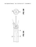 MEDICAL SYSTEMS COMPRISING OPTICAL DEVICES diagram and image