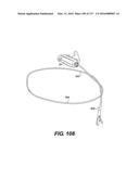 MEDICAL SYSTEMS COMPRISING OPTICAL DEVICES diagram and image