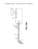 MEDICAL SYSTEMS COMPRISING OPTICAL DEVICES diagram and image