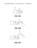 MEDICAL SYSTEMS COMPRISING OPTICAL DEVICES diagram and image