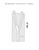 MEDICAL SYSTEMS COMPRISING OPTICAL DEVICES diagram and image