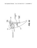 MEDICAL SYSTEMS COMPRISING OPTICAL DEVICES diagram and image