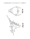 MEDICAL SYSTEMS COMPRISING OPTICAL DEVICES diagram and image