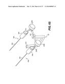 MEDICAL SYSTEMS COMPRISING OPTICAL DEVICES diagram and image