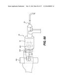 MEDICAL SYSTEMS COMPRISING OPTICAL DEVICES diagram and image