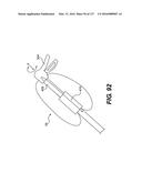 MEDICAL SYSTEMS COMPRISING OPTICAL DEVICES diagram and image